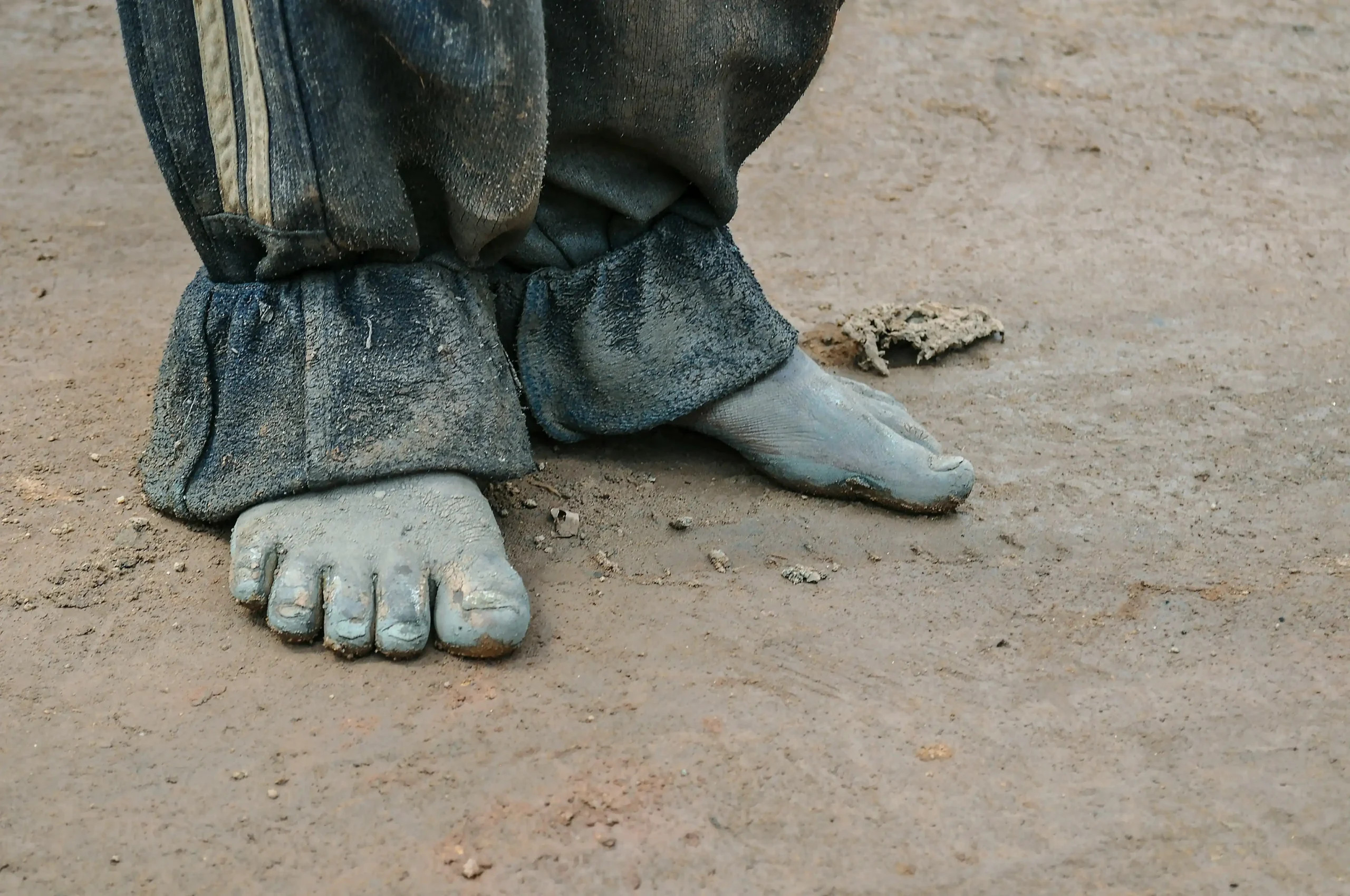 Subject: Barefoot Shoes Defects: